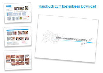 Handbook on intraoral photography . Kostenloser Download